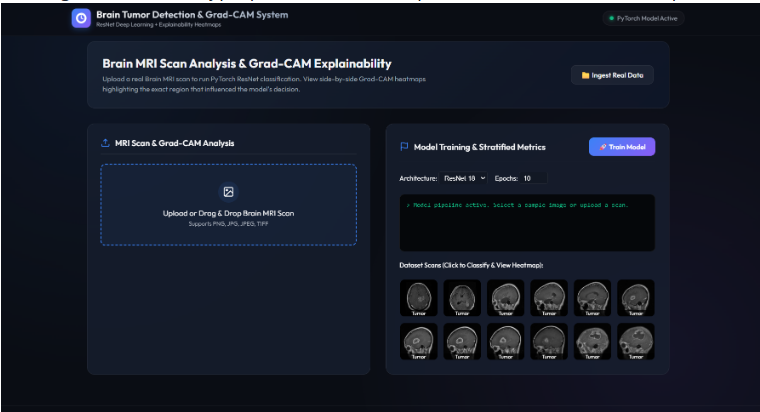Brain Tumor Detection Using Deep Learning